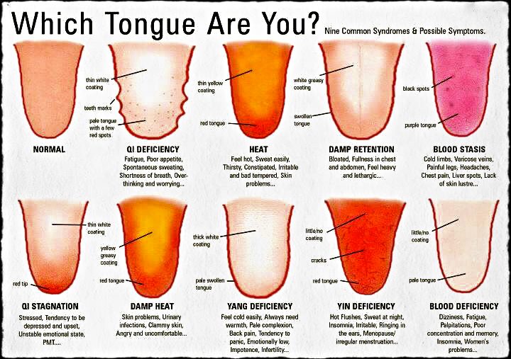 DIAGNOSTIC TONGUE MAPS ☯ - ELEMENTAL CHANGES Oriental Medicine ☯ ...